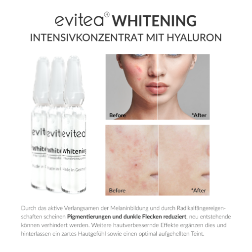 Whitening Intensivkonzentrat Ampullen Mini 2ml*2 – Bild 6
